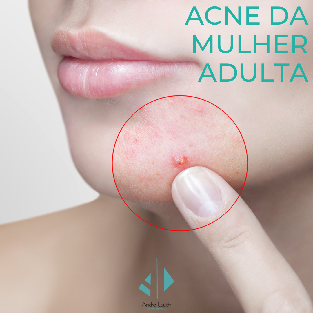 Foto de mulheres adultas