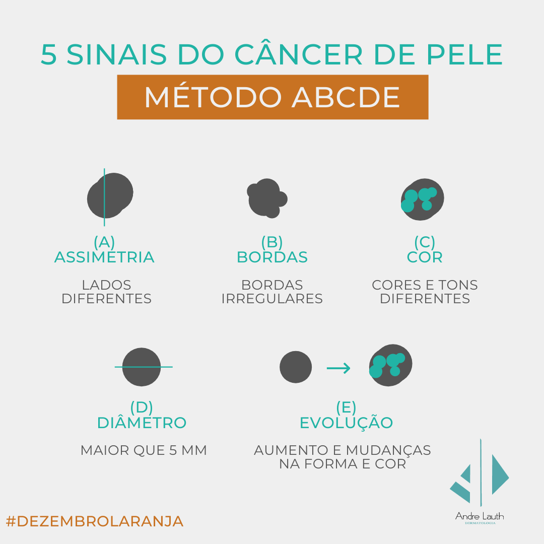 5-sinais-do-cancer-de-pele-metodo-abcde.png