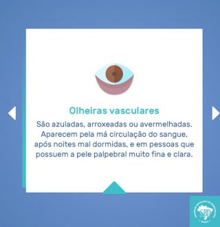 tratamento de olheiras com dermatologista