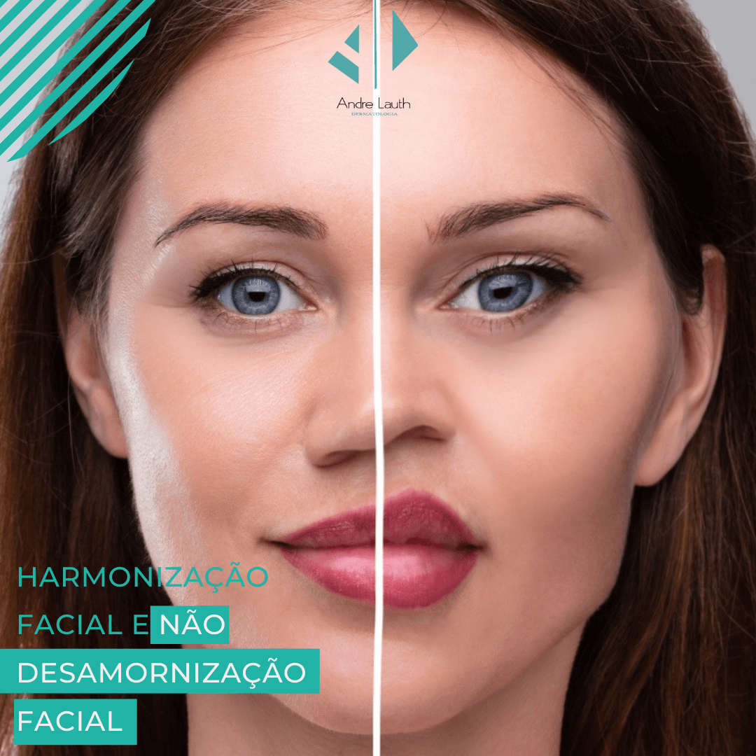 Harmoniza\u00e7\u00e3o facial ou desarmoniza\u00e7\u00e3o facial? | Andr\u00e9 Lauth | Dermato
