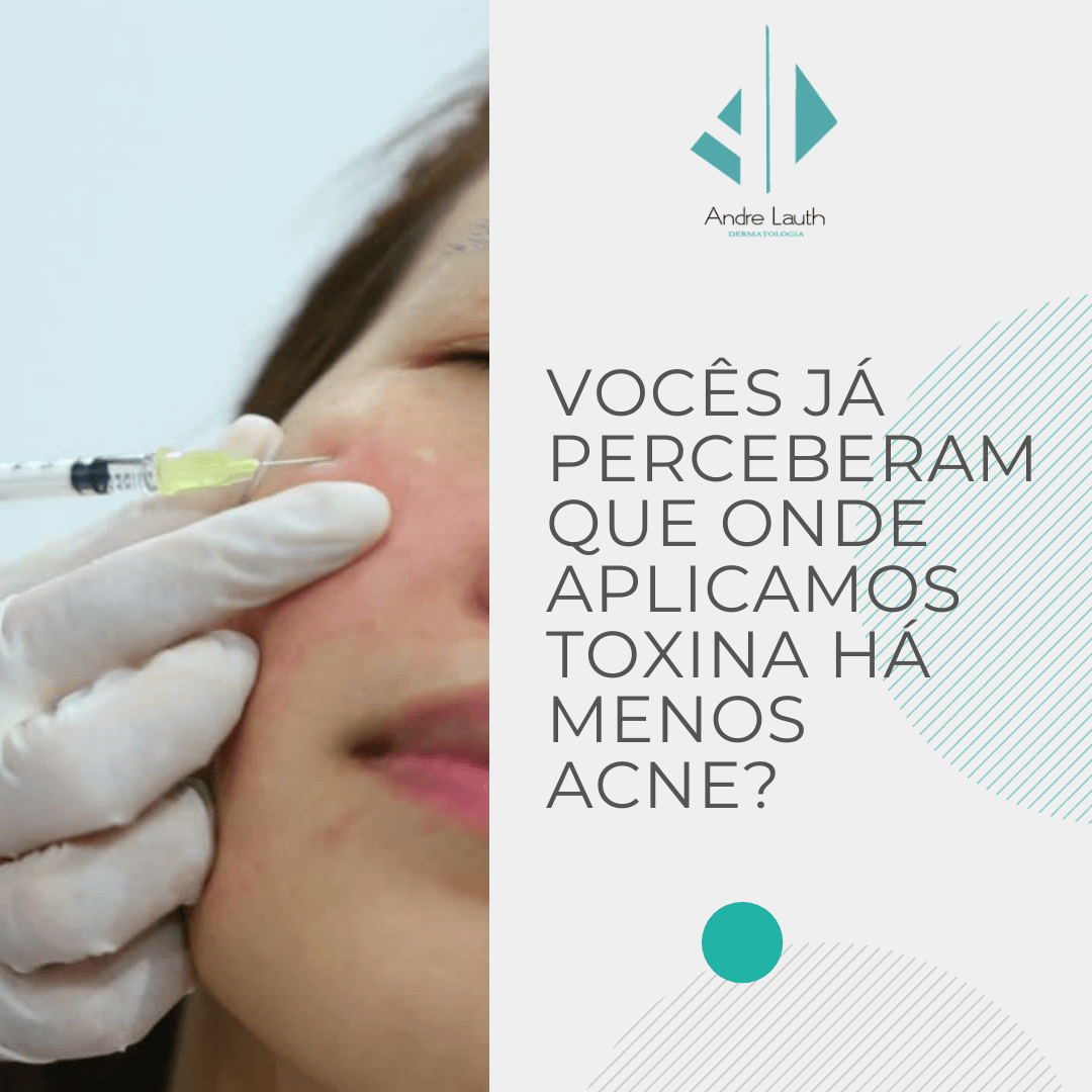 toxina-botulínica.png